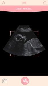 胎儿相机  v1.1.1图4